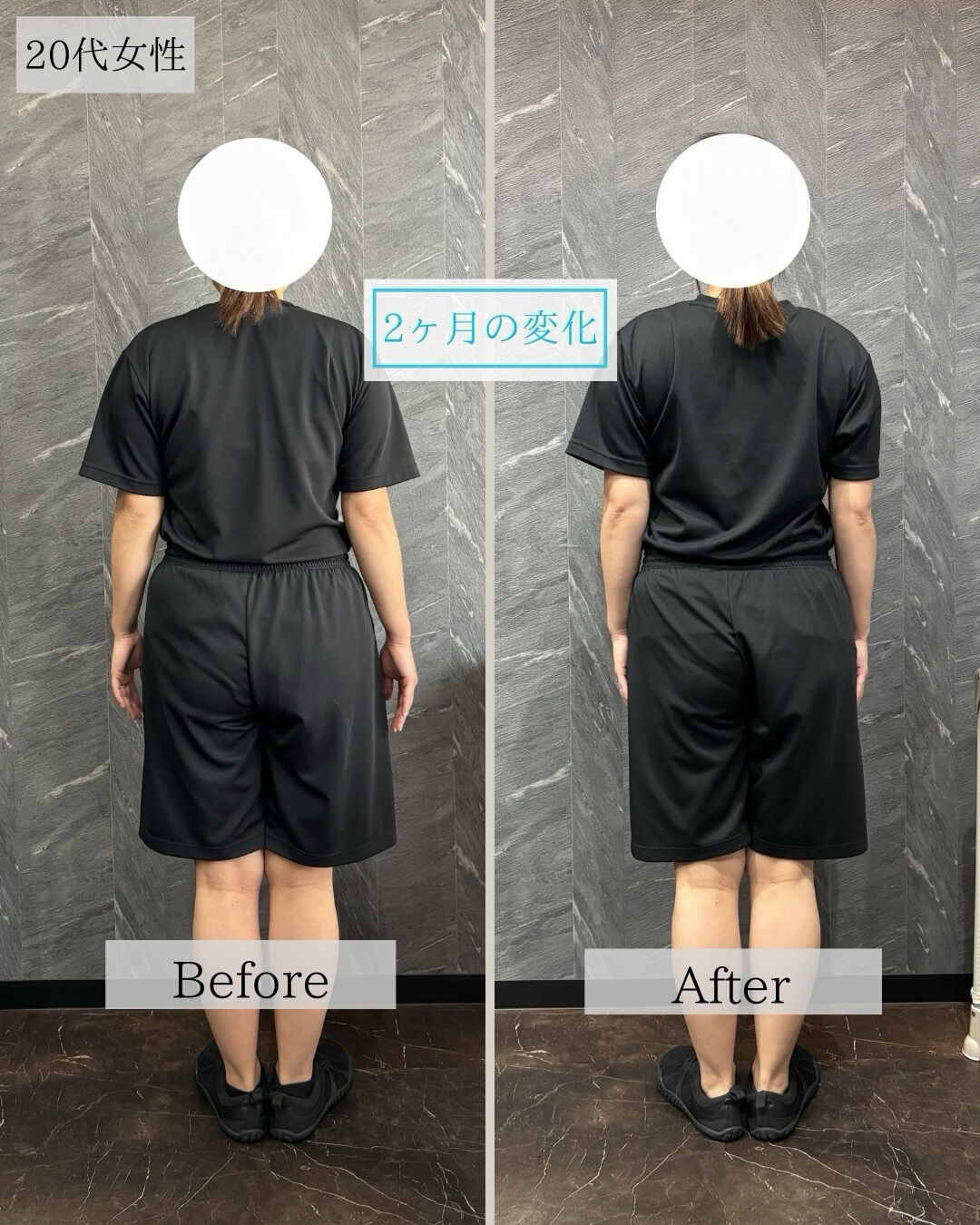 産後の20代女性のビフォーアフター