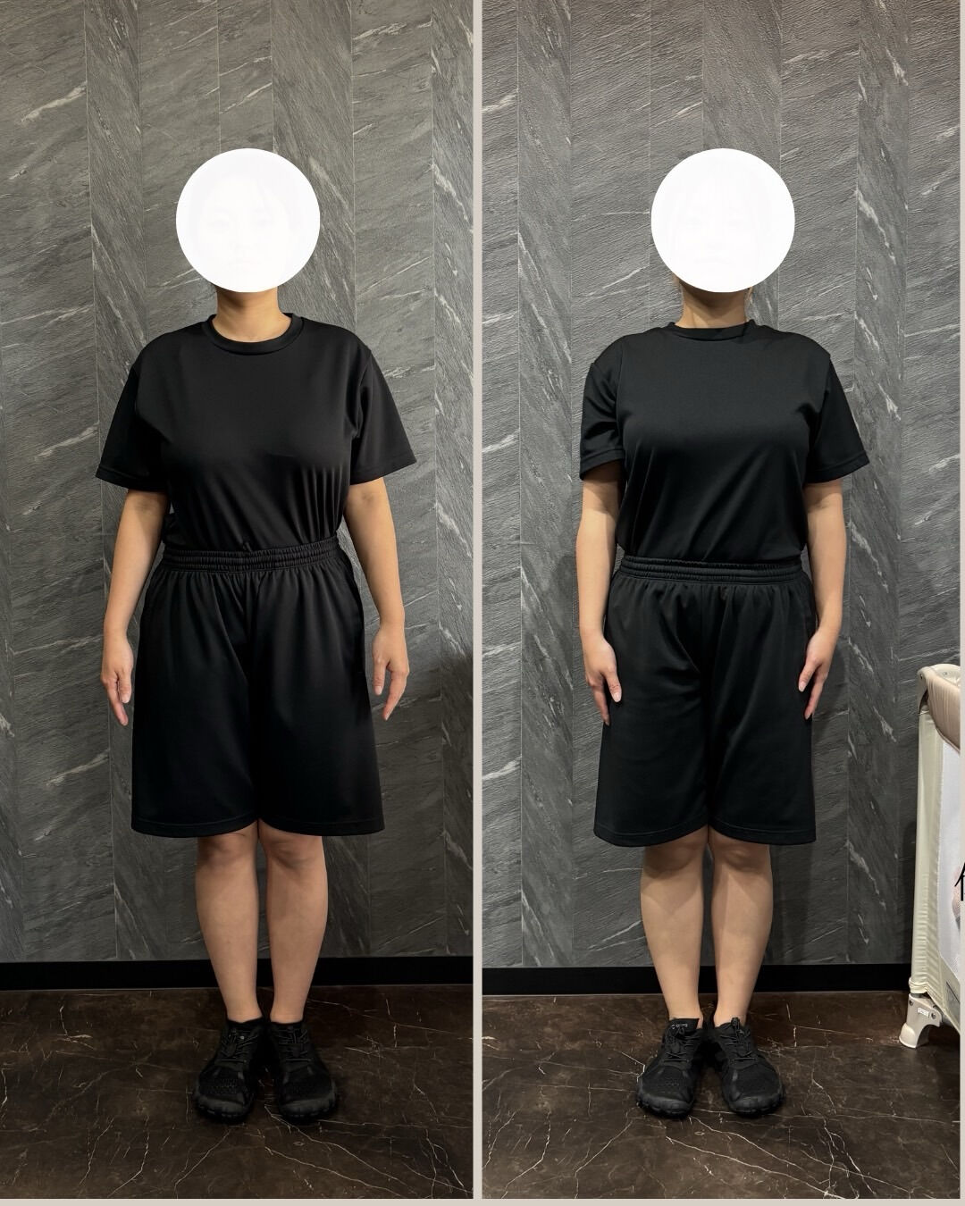 産後の20代女性のビフォーアフター