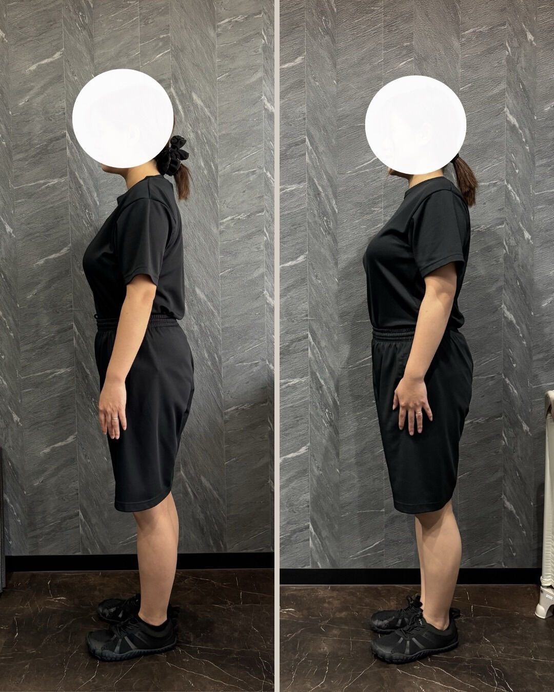 産後の20代女性のビフォーアフター