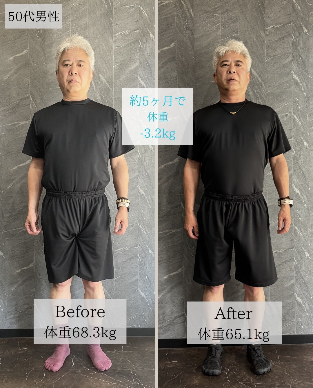 50代男性のお客様のビフォーアフターです！