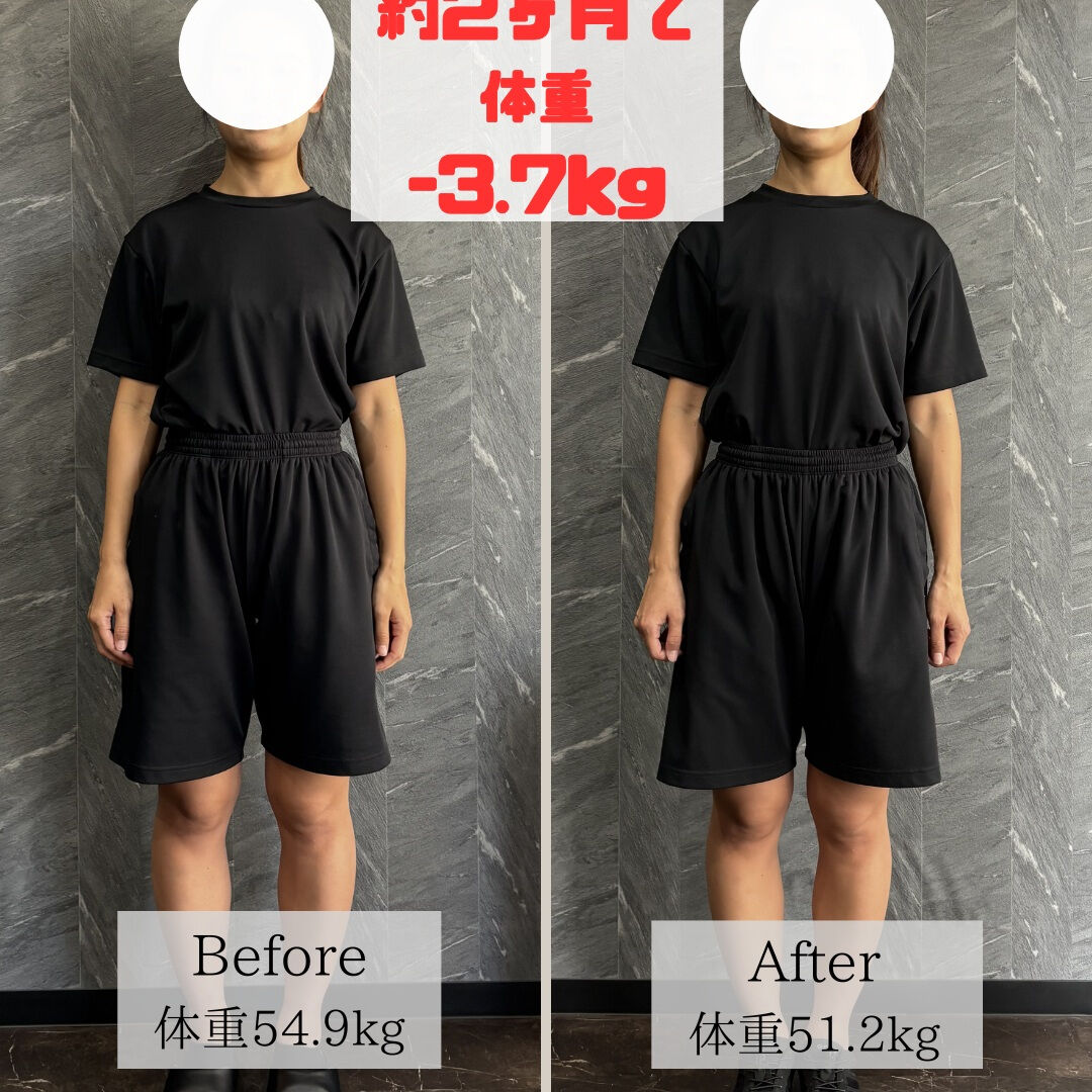 20代女性のお客様のビフォーアフターです！